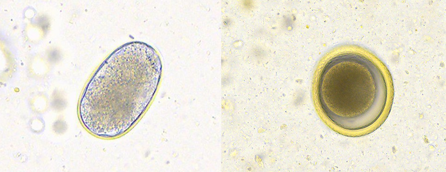 Hookworm and roundworm images